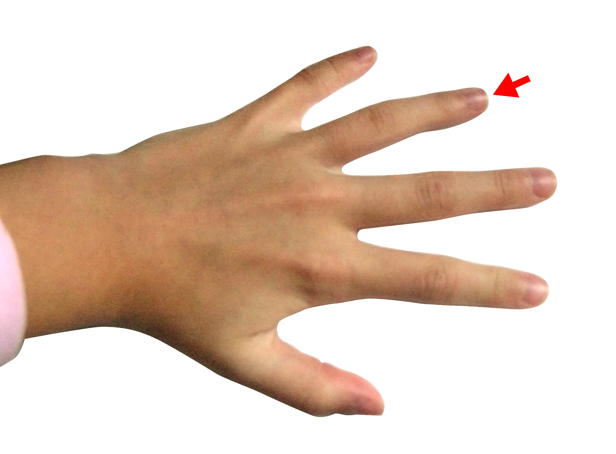 ring-finger.jpg