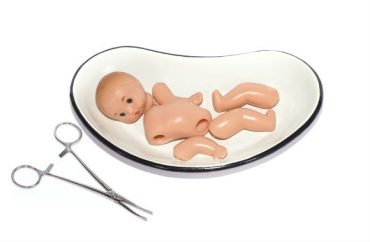 abortion-baby-pregnant.Olga_Dobrikova.shutterstock-370x242.jpg